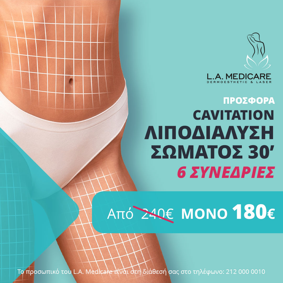 ΠΡΟΣΦΟΡΑ CAVITATION ΛΙΠΟΔΙΑΛΥΣΗ ΣΩΜΑΤΟΣ 30’ (6 συνεδρίες)